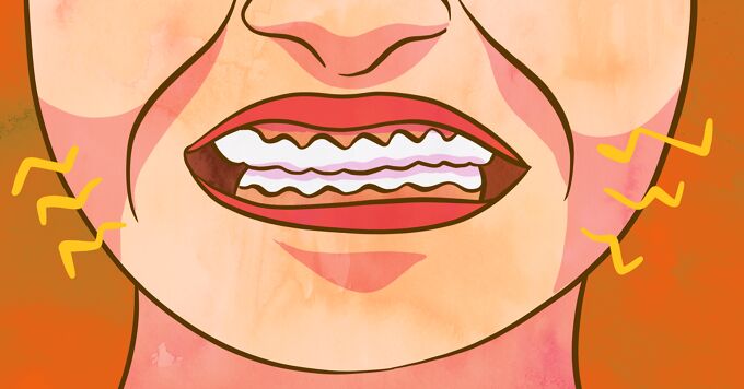 Removing Wisdom Teeth While Dealing with Respiratory Issues image