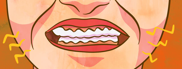 Removing Wisdom Teeth While Dealing with Respiratory Issues image
